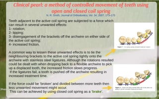 Orthodontic Coil spring