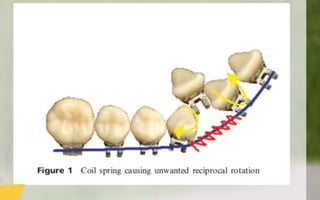 Orthodontic Coil spring