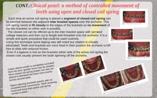 Orthodontic Coil spring