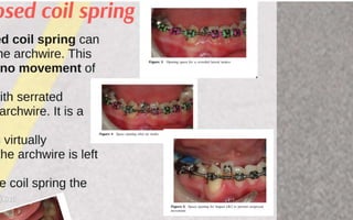 Orthodontic Coil spring