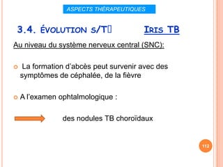 ASPECTS THÉRAPEUTIQUES


 3.4. ÉVOLUTION S/Tᵌ                    IRIS TB
Au niveau du système nerveux central (SNC):

    La formation d’abcès peut survenir avec des
    symptômes de céphalée, de la fièvre

   A l’examen ophtalmologique :

                des nodules TB choroïdaux


                                                   112
 