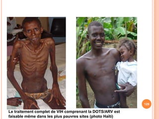 129

Le traitement complet de VIH comprenant la DOTS/ARV est
faisable même dans les plus pauvres sites (photo Haïti)
 