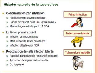 Histoire naturelle de la tuberculose




                                       27
 