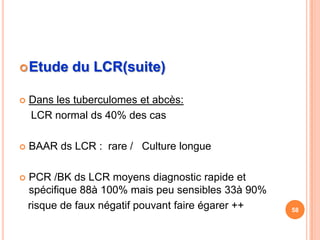  Etude     du LCR(suite)

   Dans les tuberculomes et abcès:
    LCR normal ds 40% des cas

   BAAR ds LCR : rare / Culture longue

   PCR /BK ds LCR moyens diagnostic rapide et
    spécifique 88à 100% mais peu sensibles 33à 90%
    risque de faux négatif pouvant faire égarer ++   58
 
