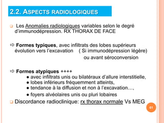 2.2. ASPECTS RADIOLOGIQUES
   Les Anomalies radiologiques variables selon le degré
    d’immunodépression. RX THORAX DE FACE

 Formes typiques, avec infiltrats des lobes supérieurs
    évolution vers l’excavation    ( Si immunodépression légère)
                                      ou avant séroconversion

 Formes atypiques ++++
         ● avec infiltrats unis ou bilatéraux d’allure interstitielle,
         ● lobes inférieurs fréquemment atteints,
         ● tendance à la diffusion et non à l’excavation…,
         ● foyers alvéolaires unis ou pluri lobaires
   Discordance radioclinique: rx thorax normale Vs MEG
                                                                         61
 