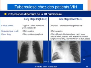 Tuberculose chez des patients VIH




                                    63
 