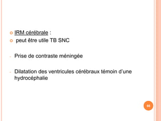  IRM cérébrale :
 peut être utile TB SNC



-   Prise de contraste méningée

-   Dilatation des ventricules cérébraux témoin d’une
    hydrocéphalie




                                                        66
 