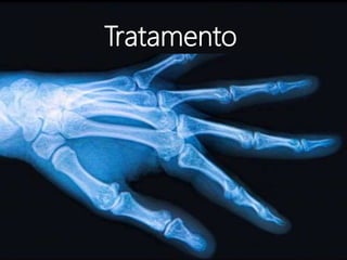 Tratamento
 
