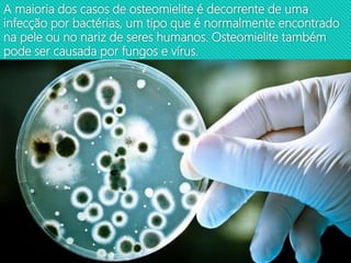 A maioria dos casos de osteomielite é decorrente de uma
infecção por bactérias, um tipo que é normalmente encontrado
na pele ou no nariz de seres humanos. Osteomielite também
pode ser causada por fungos e vírus.
 