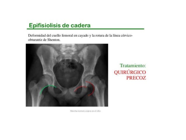 Duele la parte inferior del vientre da a la derecha en la espalda