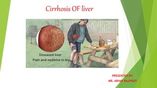 Cirrhosis OF liver
PRESENTED BY:
MR. ABHAY RAJPOOT
 
