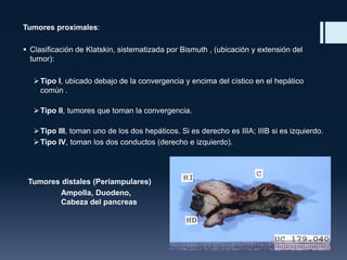 Tumores proximales:
 Clasificación de Klatskin, sistematizada por Bismuth , (ubicación y extensión del
tumor):
 Tipo I, ubicado debajo de la convergencia y encima del cístico en el hepático
común .
 Tipo II, tumores que toman la convergencia.
 Tipo III, toman uno de los dos hepáticos. Si es derecho es IIIA; IIIB si es izquierdo.
 Tipo IV, toman los dos conductos (derecho e izquierdo).

Tumores distales (Periampulares)
Ampolla, Duodeno,
Cabeza del pancreas

 