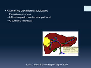  Patrones de crecimiento radiologicos
 Formadores de masa
 Infiltración predominantemente periductal
 Crecimiento intraductal

Liver Cancer Study Group of Japan 2009

 