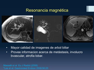 Resonancia magnética

•
•

Mayor calidad de imagenes de arbol biliar
Provee informacion acerca de metástasis, involucro
bvascular, atrofia lobar.

Masselli et al Eu J Radiol (2008)
*Lee et al. Gastrointest Endosc 2008;56:25

 