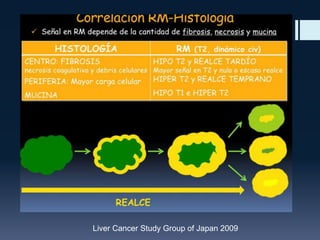 Liver Cancer Study Group of Japan 2009

 