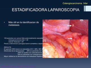 Colangiocarcinoma hilar

ESTADIFICADORA LAPAROSCOPIA
•

Más útil en la identificacion de
metástasis

100 pacientes con cancer biliar poterncialmente resecable
Colangiocarcinoma hilar = 56
Cancer Vesicular = 44
Previo a intervencion quirurgica fueron sometidos a laparoscopia

RESULTS:
En general: 69% fueron no resecables (CH = 59%, VB= 82%)
Efectividad de la laparoscopia: 48% en pacientes con vesicular biliar
(56% en quellos con colecistectomia previain)
25% en pacientes con colangiocarcinoma hilar
Mayor utilidad en la demostracion de matastasis hepática y peritoneal

Weber et al. Ann Surg 235:392 (2002)

 