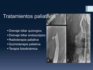 Tratamientos paliativos
 Drenaje biliar quirurgico
 Drenaje biliar endoscópico
 Radioterapia paliativa
 Quimioterapia paliativa
 Terapia fotodinámica

 