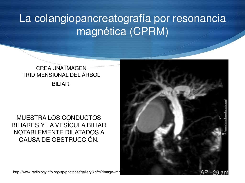 Colangiocarcinoma