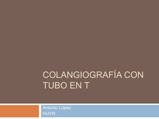 COLANGIOGRAFÍA CON
TUBO EN T
Antonio López
HUVN
 