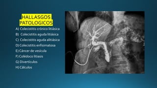 colangeografia transkherprosedimiento0.2 | PDF
