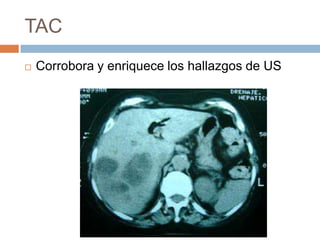 TAC
 Corrobora y enriquece los hallazgos de US
 