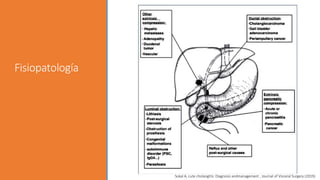Fisiopatología
Sokal A, cute cholangitis: Diagnosis andmanagement , Journal of Visceral Surgery (2019)
 