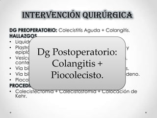 INTERVENCIÓN QUIRÚRGICA
DG PREOPERATORIO: Colecistitis Aguda + Colangitis.
HALLAZGOS
• Liquido Ascítico turbio 500 ml.
• Plastrón conformado por vesícula biliar, hígado y
epiplón.
• Vesícula biliar de paredes gruesas, edematosas,
contenido pus
• Vía biliar de +/- 1cm de diámetro contenido pus.
• Vía biliar no se logra permeabilizar hacia el duodeno.
• Piocolecisto 20 cc.
PROCEDIMIENTO REALIZADO
• Colecistectomía + Colecistostomía + Colocación de
Kehr.
Dg Postoperatorio:
Colangitis +
Piocolecisto.
 
