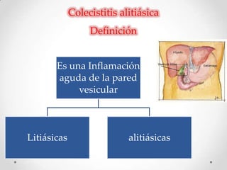Colecistitis alitiásica
Definición
Es una Inflamación
aguda de la pared
vesicular
Litiásicas alitiásicas
 