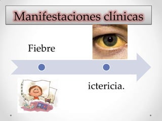 Fiebre
ictericia.
Manifestaciones clínicas
 