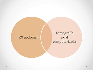 RX abdomen
Tomografía
axial
computarizada
 