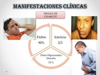 MANIFESTACIONES CLÍNICAS
Ictericia
2/3
Dolor Hipocondrio
Derecho
70 %
Fiebre
90%
TRIADA DE
CHARCOT
 