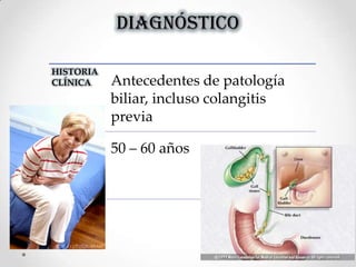 DIAGNÓSTICO
HISTORIA
CLÍNICA Antecedentes de patología
biliar, incluso colangitis
previa
50 – 60 años
 