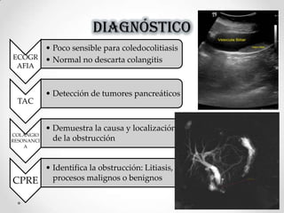 DIAGNÓSTICO
ECOGR
AFIA
• Poco sensible para coledocolitiasis
• Normal no descarta colangitis
TAC
• Detección de tumores pancreáticos
COLANGIO
RESONANCI
A
• Demuestra la causa y localización
de la obstrucción
CPRE
• Identifica la obstrucción: Litiasis,
procesos malignos o benignos
 