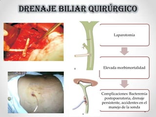 DRENAJE BILIAR QUIRÚRGICO
Laparotomía
Elevada morbimortalidad
Complicaciones: Bacteremia
postopoeratoria, drenaje
persistente, accidentes en el
manejo de la sonda
 