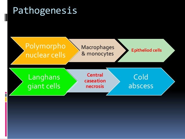 Cold abscess lymph nodes in neck diagram 