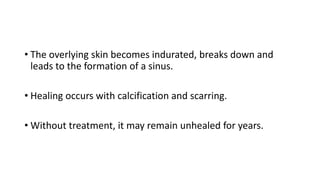 • The overlying skin becomes indurated, breaks down and
leads to the formation of a sinus.
• Healing occurs with calcification and scarring.
• Without treatment, it may remain unhealed for years.
 