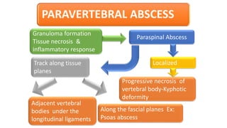 Granuloma formation
Tissue necrosis &
inflammatory response
Paraspinal Abscess
LocalizedTrack along tissue
planes
Progressive necrosis of
vertebral body-Kyphotic
deformity
Adjacent vertebral
bodies under the
longitudinal ligaments
Along the fascial planes Ex:
Psoas abscess
PARAVERTEBRAL ABSCESS
 