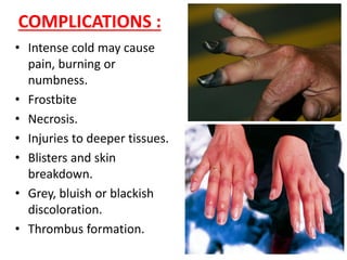 COMPLICATIONS :
• Intense cold may cause
pain, burning or
numbness.
• Frostbite
• Necrosis.
• Injuries to deeper tissues.
• Blisters and skin
breakdown.
• Grey, bluish or blackish
discoloration.
• Thrombus formation.
 