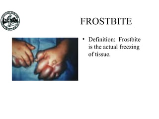 FROSTBITE
• Definition: Frostbite
is the actual freezing
of tissue.
 