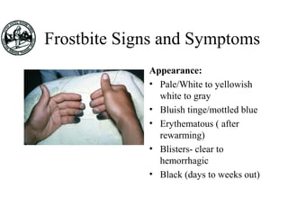 Frostbite Signs and Symptoms
Appearance:
• Pale/White to yellowish
white to gray
• Bluish tinge/mottled blue
• Erythematous ( after
rewarming)
• Blisters- clear to
hemorrhagic
• Black (days to weeks out)
 