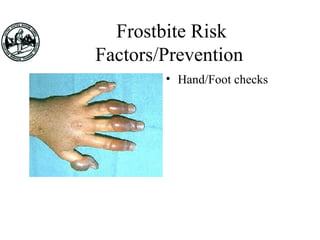 Frostbite Risk
Factors/Prevention
• Hand/Foot checks
 