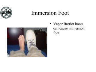 Immersion Foot
• Vapor Barrier boots
can cause immersion
foot
 