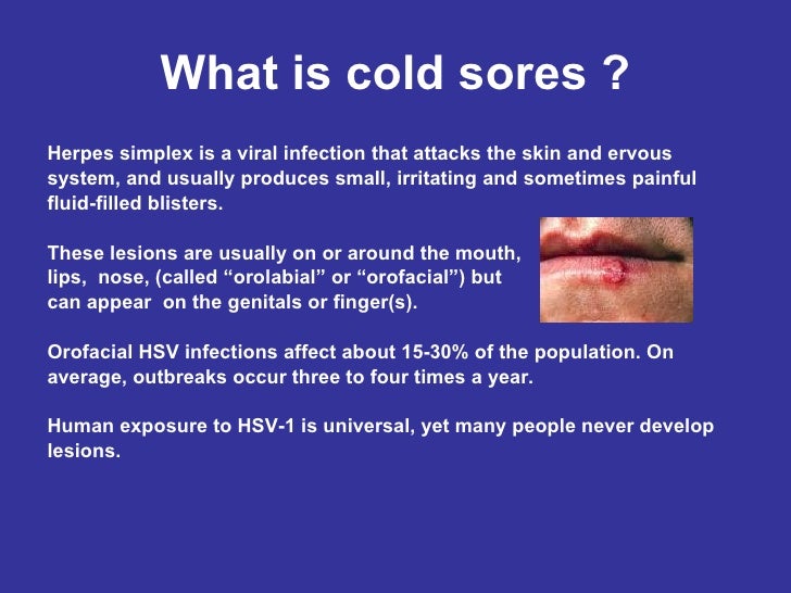 what causes cold sore outbreaks what causes cold sore outbreaks