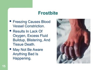 15
 Freezing Causes Blood
Vessel Constriction.
 Results In Lack Of
Oxygen, Excess Fluid
Buildup, Blistering, And
Tissue Death.
 May Not Be Aware
Anything Bad Is
Happening.
Frostbite
 