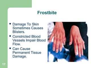 17
 Damage To Skin
Sometimes Causes
Blisters.
 Constricted Blood
Vessels Impair Blood
Flow.
 Can Cause
Permanent Tissue
Damage.
Frostbite
 