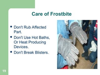 19
 Don’t Rub Affected
Part.
 Don’t Use Hot Baths,
Or Heat Producing
Devices.
 Don’t Break Blisters.
Care of Frostbite
 