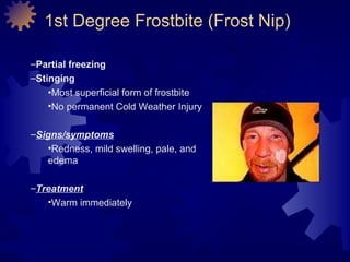 Forstbite Form Cold weathe | PPT