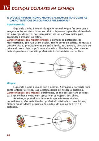 IV DOENÇAS OCULARES NA CRIANÇA 
1) O QUE É HIPERMETROPIA, MIOPIA E ASTIGMATISMO E QUAIS AS 
CARACTERÍSTICAS DAS CRIANÇAS PORTADORAS? 
Hipermetropia: 
Miopia: 
16 
É quando o olho é menor do que o normal, o que faz com que a 
imagem se forme atrás da retina. Muitos hipermétropes têm dificuldade 
em enxergar de perto, pois necessitam de um esforço maior para 
acomodar a imagem na retina. 
Características dos hipermétropes: é comum os portadores de 
hipermetropia, que não usam óculos, terem dores de cabeça, tonturas e 
cansaço visual, principalmente se estão lendo, escrevendo, pintando ou 
brincando com objetos próximos dos olhos. Geralmente, são crianças 
mais dispersivas e que dão preferência às brincadeiras ao ar livre. 
É quando o olho é maior que o normal. A imagem é formada num 
ponto anterior a retina. Isso acarreta perda de nitidez à distância. 
Características dos míopes: geralmente, os míopes apertam os olhos 
para ver melhor e costumam aproximar os objetos dos olhos. 
As crianças portadoras de miopia que não usam óculos, 
normalmente, são mais tímidas, preferindo atividades como leitura, 
pintura ou atividades próximas das mãos, do que ao ar livre e à 
distância. 
 