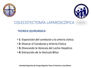COLECISTECTOMÍA LAPAROSCÓPICA
TECNICA QUIRURGICA
• 1: Exposición del conducto y la arteria cística
• 2: Disecar el Conducto y Arteria Cística
• 3: Disecando la Vesícula del Lecho Hepático
• 4: Extracción de la Vesícula Biliar
Sociedad Argentina de Cirugía Digestiva Tomo IV Vesícula y vías biliares
 