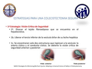 ESTRATEGIAS PARA UNA COLECISTECTOMIA SEGURA
• 1ª Estrategia: Visión Crítica de Seguridad
• 1ª. Disecar el tejido fibroadiposo que se encuentra en el
hepatocistico.
• 1b. Liberar el tercio inferior de la vesícula biliar de su lecho hepático
• 1c. Se encontraran solo dos estructuras que ingresan a la vesícula: la
arteria cística y el conducto cístico. Se obtiene la visión crítica de
seguridad anterior y posterior
SAGES.!Strategies for Minimizing Bile Duct Injuries: Adopting a Universal Culture of Safety in Cholecystectomy
 